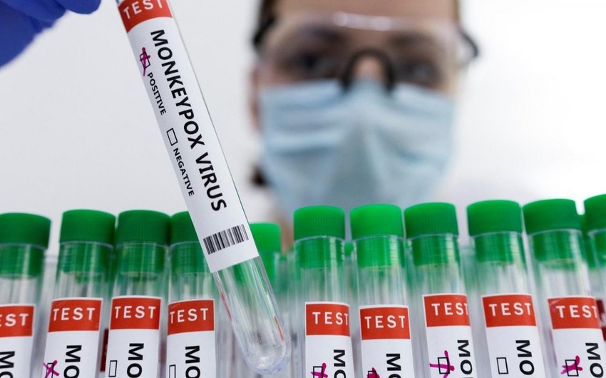 9122b23a 91cd 3e38 860f 74642cd75b11