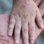 B7018ed5 f512 37c4 ace2 f785e3f09868