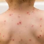 Indir 2023 12 15T122528.743